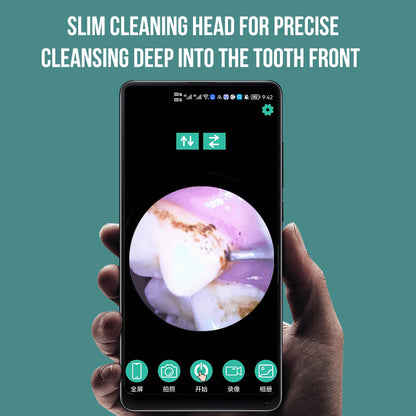 The tool of Plaque Remover for Teeth, with LED light